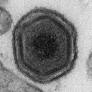 African_swine_fever_virus_virion_TEM